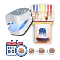 Laser Therapy, Pain-Free For Nail Fungus