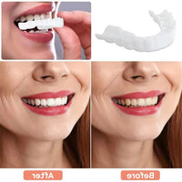 Veneers for Teeth with Natural White Finish