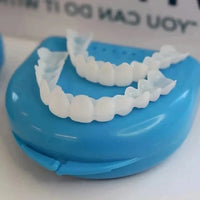 Veneers for Teeth with Natural White Finish