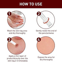 Tags & Moles Remover