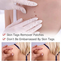 Tags & Moles Remover